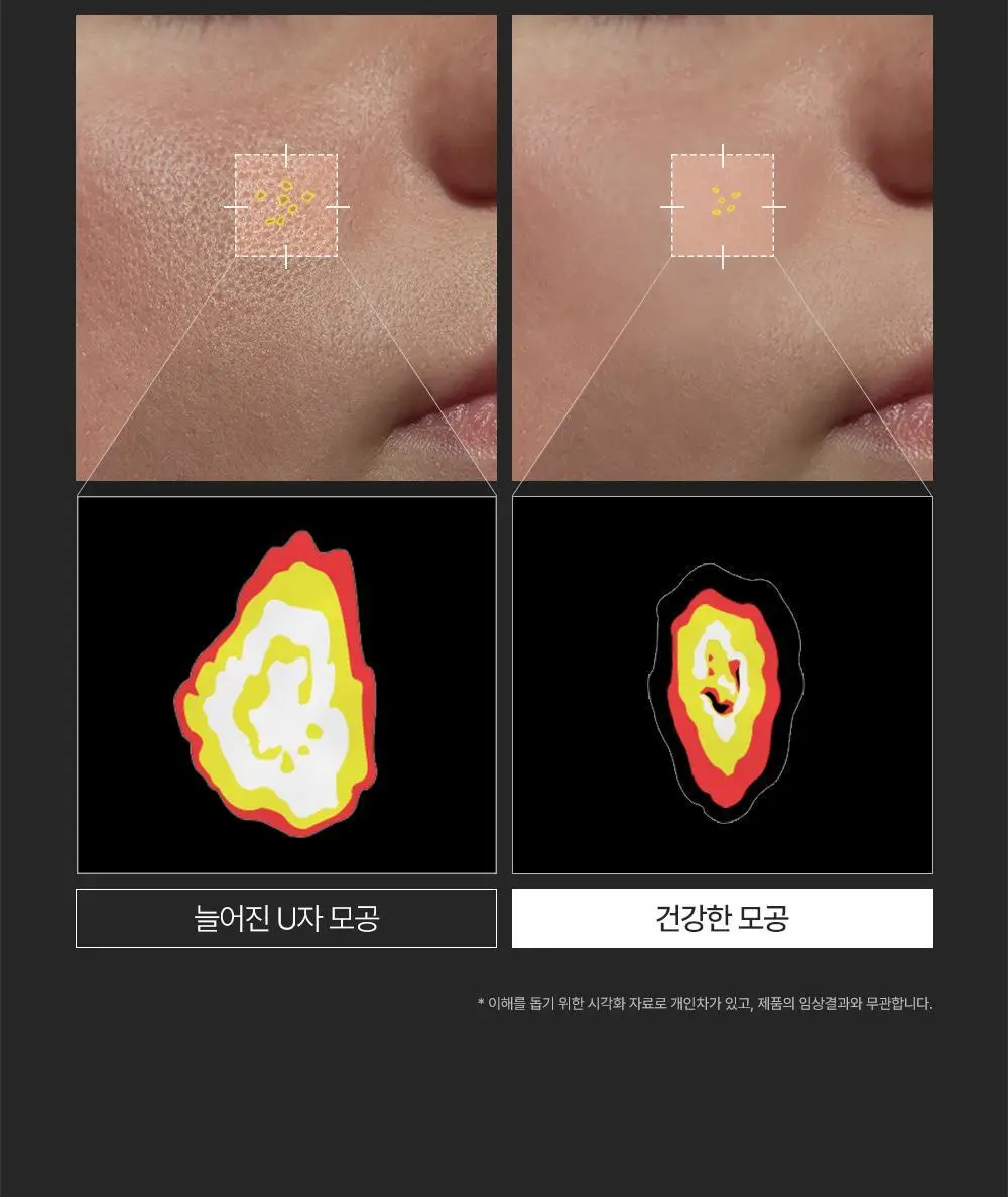 [박지현 PICK/U자모공 말끔 흡착케어] 피캄 레티놀라겐 앰플샷 폼클렌저 120ml 상세페이지 9